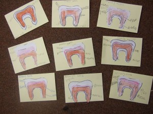 model teeth 2
